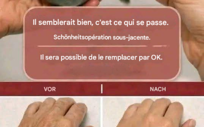 « On dirait que j’ai subi une opération ! » Un remède maison contre les rides et les taches de vieillesse sur les mains et les bras. ✨Pour