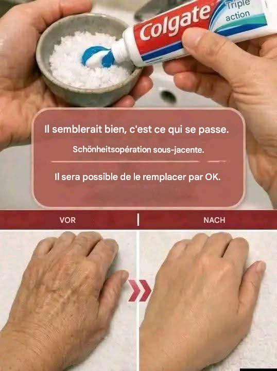 « On dirait que j’ai subi une opération ! » Un remède maison contre les rides et les taches de vieillesse sur les mains et les bras. ✨Pour