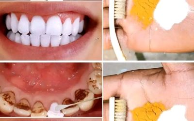 Blanchiment dentaire à domicile : obtenez des dents plus blanches en seulement 2 minutes !