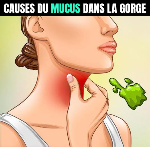Les vraies causes des glaires et du mucus constant dans la gorge et comment s’en débarrasser
