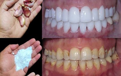 Comment blanchir les dents en 2 minutes ?