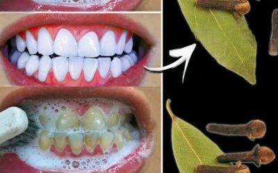 Eliminez le tartre et blanchissez vos dents naturellement