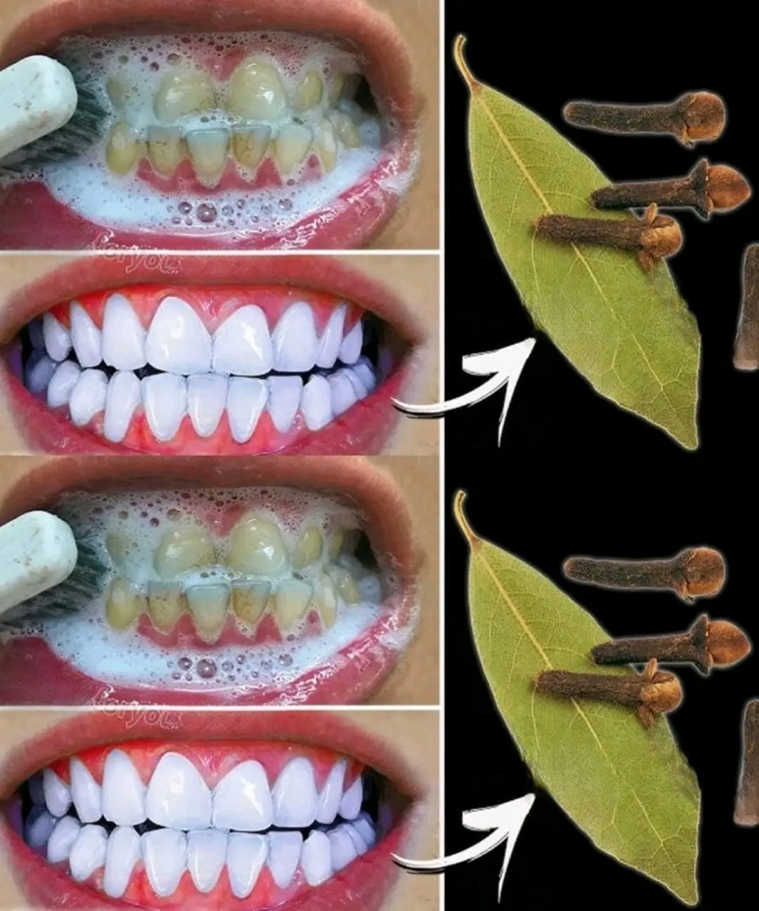 Eliminez le tartre et blanchissez vos dents naturellement