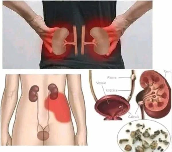 Voici les 6 aliments qui nettoient vos reins !!